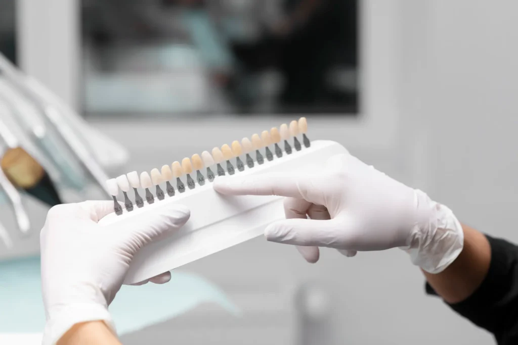 Shade guide with protective gloves used in Veneers Chicago procedures for color matching.